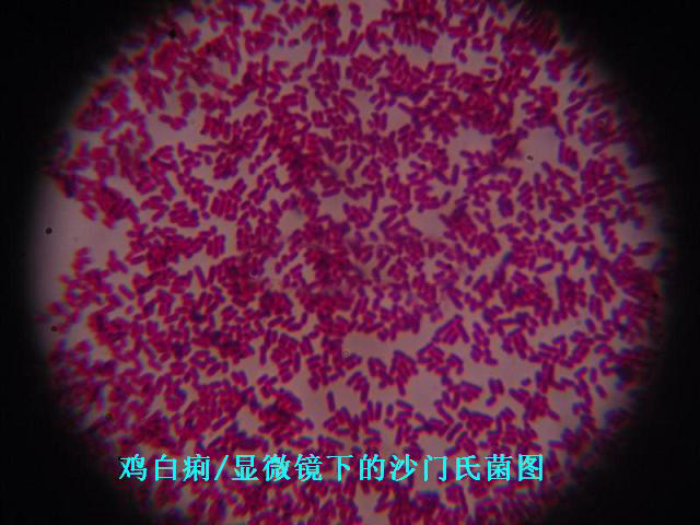 沙门菌显微镜图片
